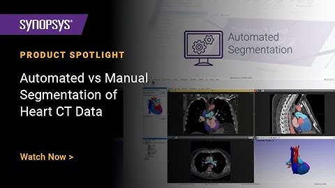 Automated vs Manual Segmentation of Heart CT Data in Simpleware Software