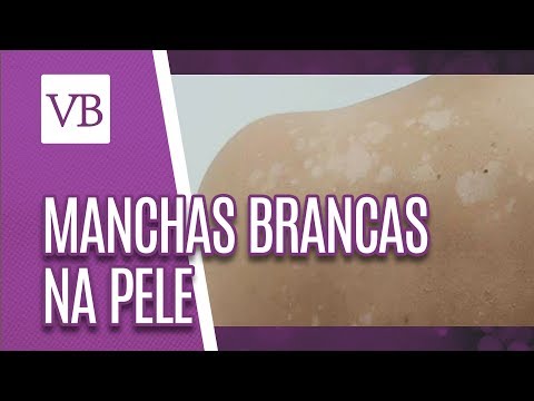 Vídeo: Manchas Solares Na Pele: Causas E Tratamento