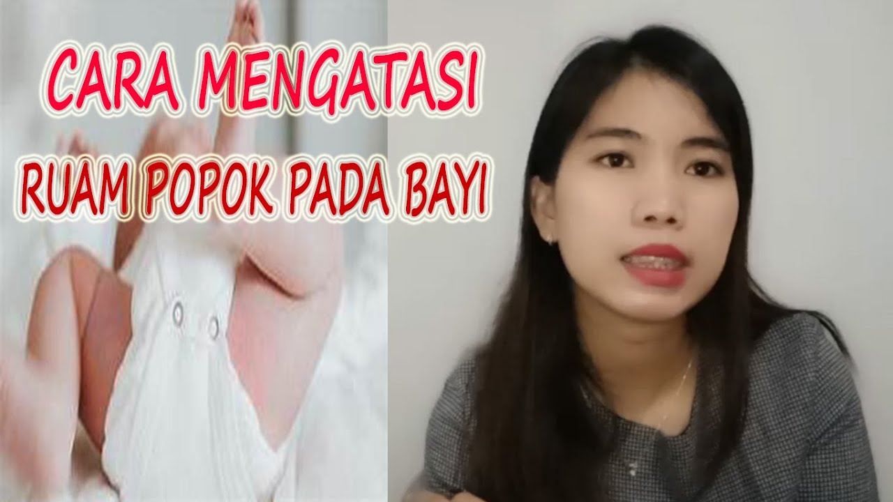 CARA MENGATASI RUAM POPOK PADA BAYI 