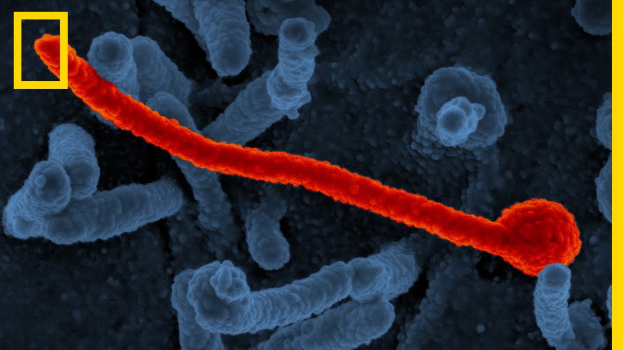 Tout comprendre sur : Ebola