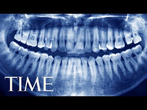 Video: Un Băiat în Vârstă De șapte Ani Avea O Tumoare Cu 526 De „dinți” Scoși Din Maxilarul Inferior - - Vedere Alternativă