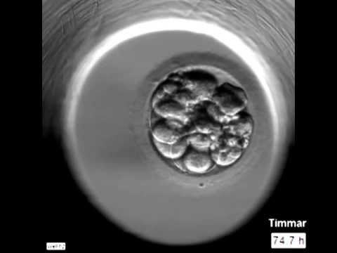 Video: Vad är embryo diskutera utvecklingen av ett tvåhjärtat embryo?