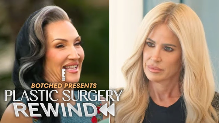 Full Episode: Welcome to the Rewind Retreat | Botched Presents: Plastic Surgery Rewind | E!