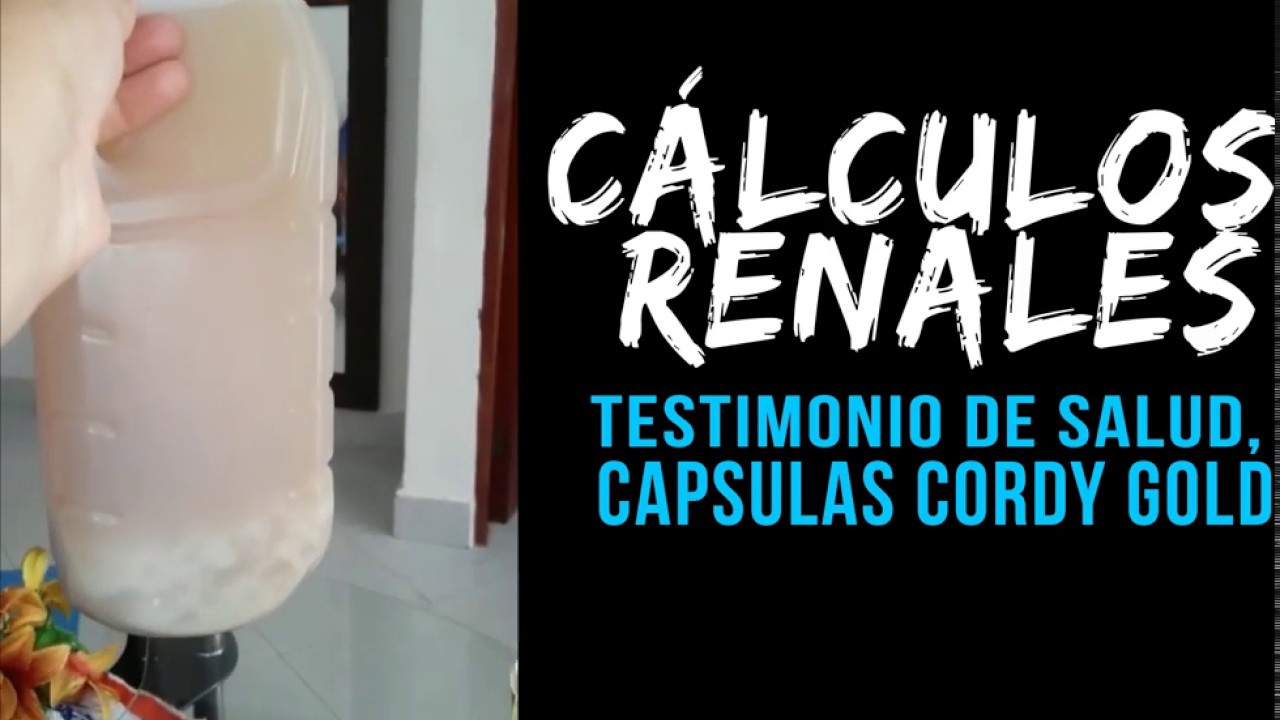 endometriosis y cálculos renales