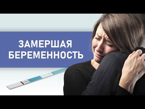 Причины замирания беременности. Выкидыш на раннем сроке