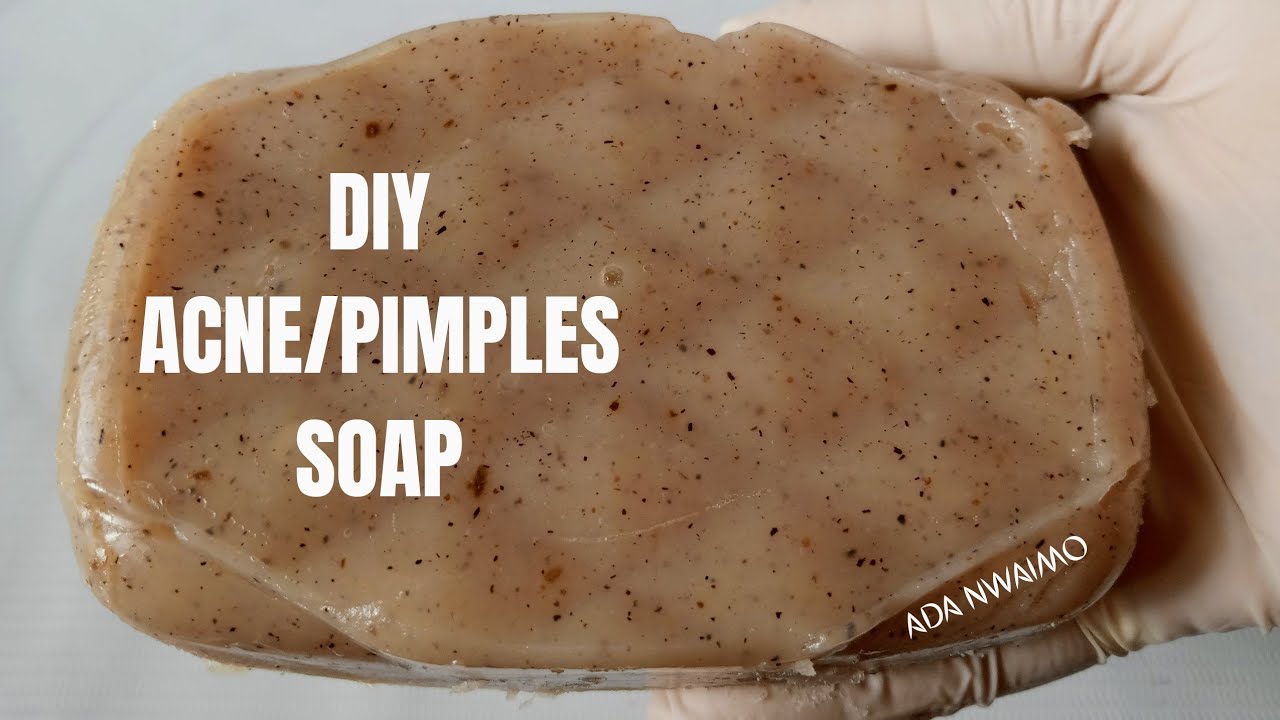 DIY Natural Pimples and Acne Soap Homemade Pimples Soap YouTube