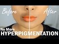 Hide Darkness Around Mouth Using BLUSH - The Correct Way To Color Correct - MrJovitaGeorge