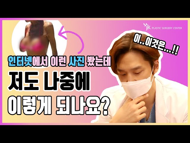 🌟전문의피셜🌟 가슴 수술 후 살 빠지면 보형물 티 날까요 ❔❕