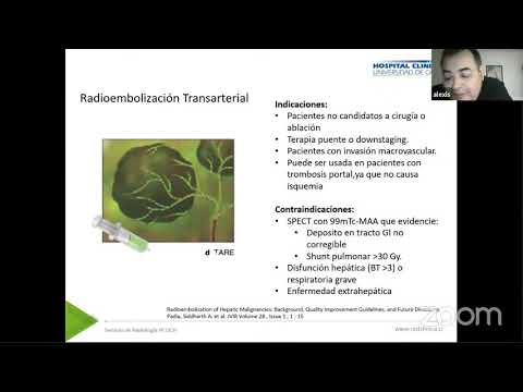 ACTUALIZACIÓN – MANEJO INTEGRAL DEL HEPATOCARCINOMA III