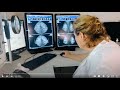 Innovation et expertise avec le nouveau mammographe 3d iris grim  sant atlantique