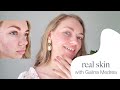 Real skin with Galina Medrea - Acne Positivity