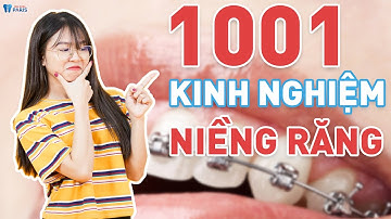 Chia sẻ 1001 kinh nghiệm niềng răng cần biết