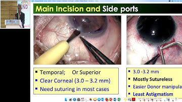 AIOC2019   IC134   Topic   Manual Dissection and Basic steps in EK   Dr Samar Kumar Basak  x264