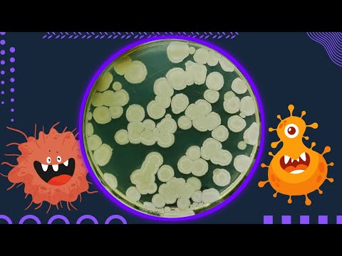 Does Nutrient Agar Have Differential Properties