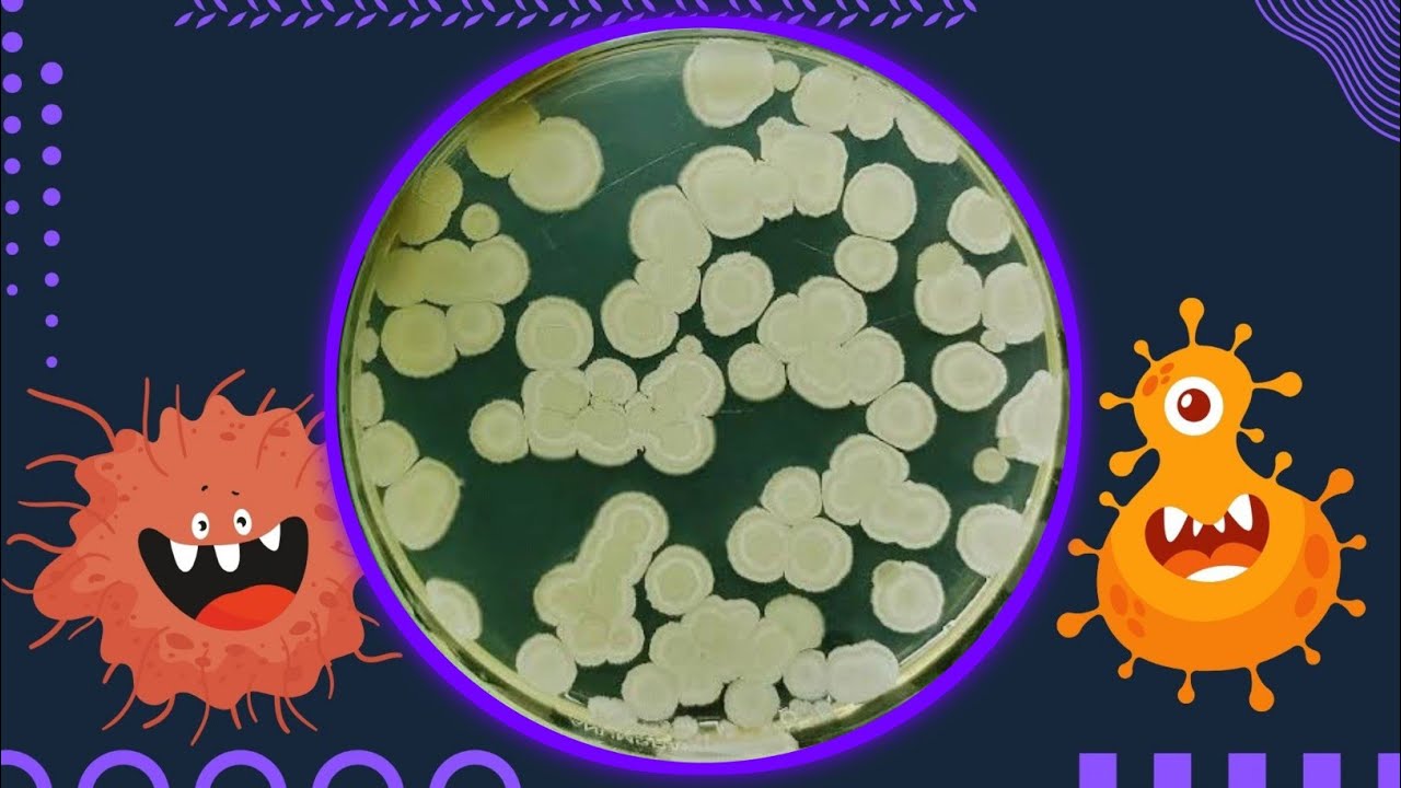 Nutrient Agar in Microbiology | Uses, Appearance, and Bacteria Grown