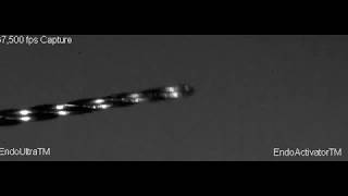 EndoUltra® vs EndoActivator™ High Speed Camera Footage