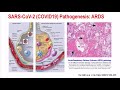 SARS - CoV-2 (COVID19), una pandemia - Dr. Josep Maria Miró PostCROI 2020