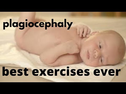 Βίντεο: Ποιο είναι το καλύτερο κέντρο δραστηριοτήτων για ένα μωρό;