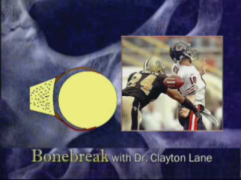 Shoulder Dislocation