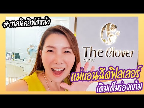 แม่แอนฉีดฟิลเลอร์เติมเต็มร่องแก้ม เทคนิคลิฟต์หน้า