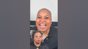 Female #hairloss Transformation Before & After #scalpmicropigmentation #alopecia #result #haircut