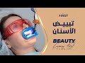 تجارب زراعة الاسنان في تركيا DENTAL IMPLANTS TURKEY COST 00905396114484