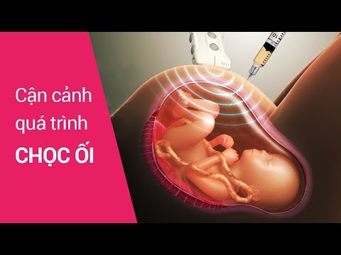 Video Chọc ối - youtube