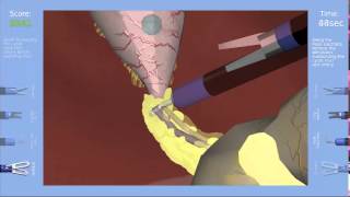 SinaSim Laparoscopic Surgery Trainer - Overview
