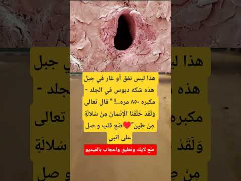 هذا ليس نفق أو غار في جبل هذه شكه دبوس في الجلد مكبره ٨٥٠ مره قال تعالى  اكسبلور