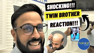 Shocking! Hair System Reaction! Before & After/Non-Surgical Hair Replacement System Men/Women UK/USA