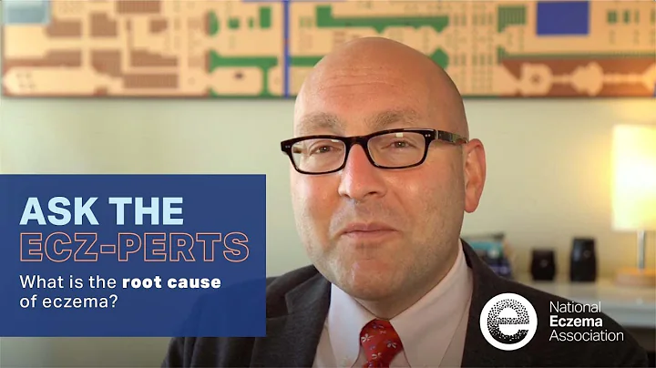 Dr. Peter Lio Answers "What is the Root Cause of Eczema?" | Ask the Ecz-perts