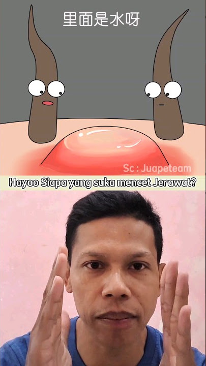 Download lagu Suka Mecahin Jerawat, iih ?!! #shorts #animation #cartoon #storytelling