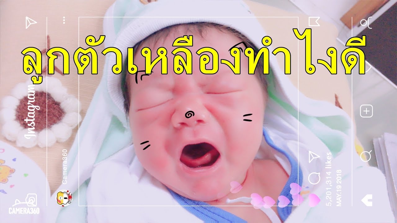 พยาบาลอลีนา : ลูกน้อยตัวเหลืองทำไงดี