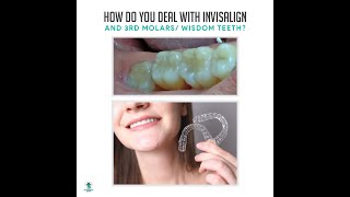 How do you Deal with Invisalign and 3rd molars/ Wisdom Teeth?