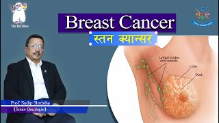 Breast Cancer (स्तन क्यानसर) Dr. Sudip Shrestha