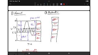 Pulmonary Function Test   Part 2   Spirometry  Normal, Obstructive and Restrictive Lung