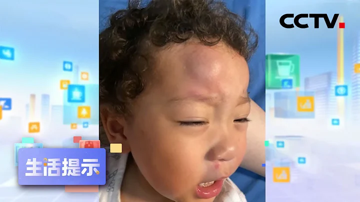 寶寶摔到頭 家長如何應對？20210728 |《生活提示》CCTV科教 - 天天要聞