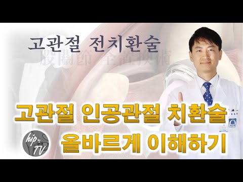 고관절 전치환술을 올바르게 이해하기