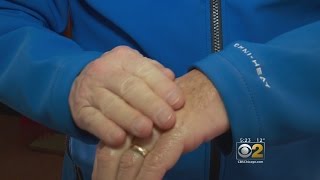 Mobile Weather Lab: How To Protect Your Skin From The Bitter Cold