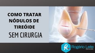 Como Tratar Nódulo De Tireoide Sem Cirurgia [Dr. Rogério Leite]