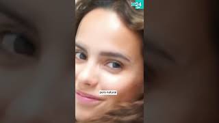 👁️ MODA PERIGOSA | Varias 'INFLUENCERS' pasan polo QUIRÓFANO para CAMBIAR a COR de OLLOS!