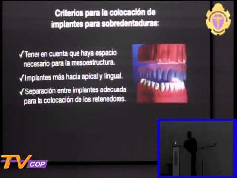 03 Implantología del edéntulo completo negocios desde casa