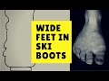 Wide Feet in Ski Boots - Bootorials Ep. 33