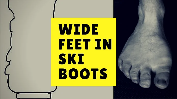 Comment adapter vos chaussures de ski à vos pieds larges ?