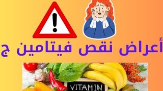 أعراض نقص فيتامين ج _ vitamin c