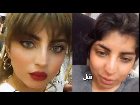زينب صباح بعد وقبل عمليه التجميل بمكياج وبدون مكياج