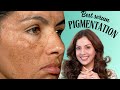 Shocking Results: Premium Dark Spot Serums Compared I Melasyl versus Thiamidol Vs MelaMe by Asaya.