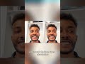 Discover new features in Invisalign® Outcome Simulator Pro
