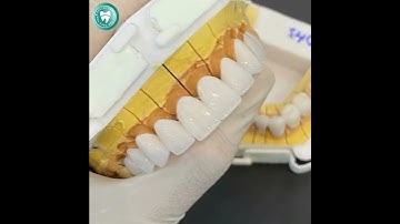 💎 Răng sứ – Bí quyết nâng tầm nụ cười chuẩn sao!