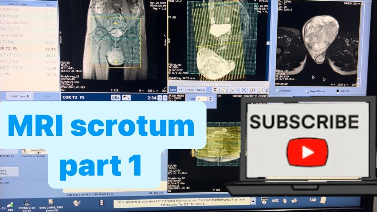 MRI scrotum or testicular part 1 full ￼ knowledge #mri #khowledge #medical #radiologytechnologist ￼￼